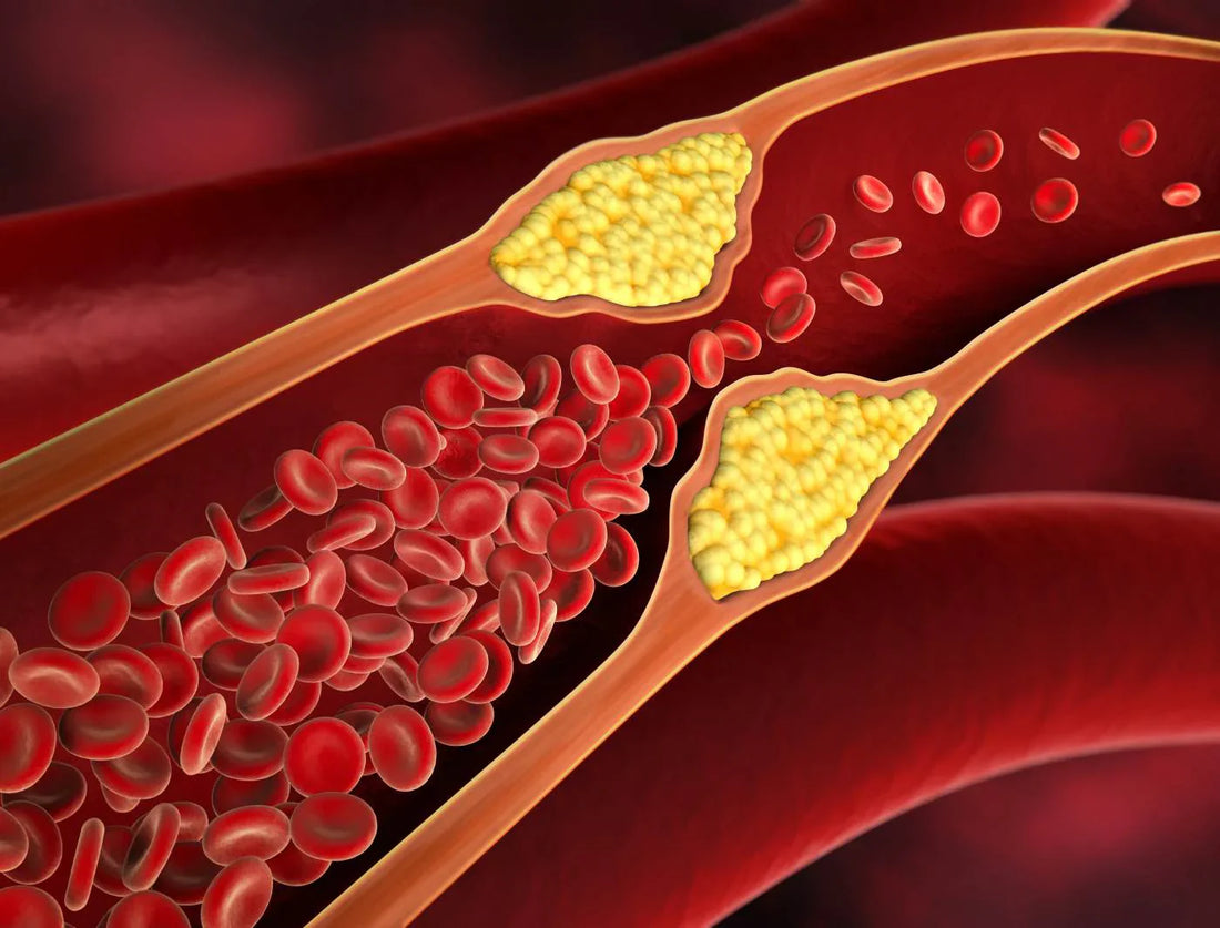 The Reason Your Cholesterol Keeps Climbing Is Not What You Were Told